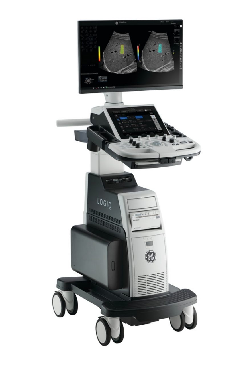 GE HealthCare LOGIQ P10 초음파 진단 장비